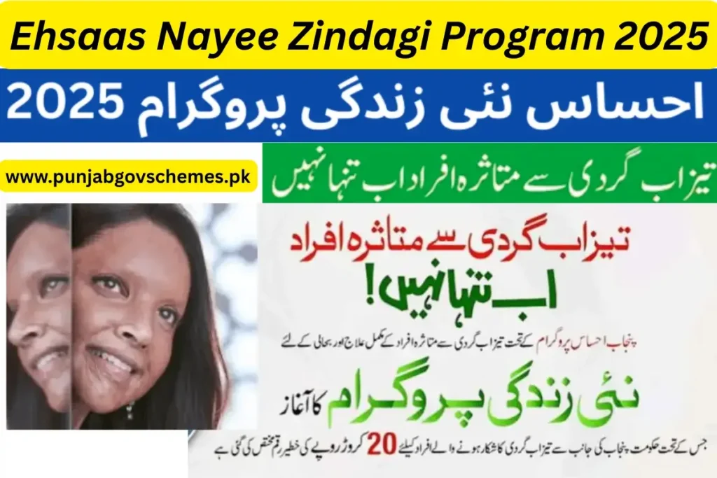 Ehsaas Nayee Zindagi Program 2025 for Acid Attack Survivors